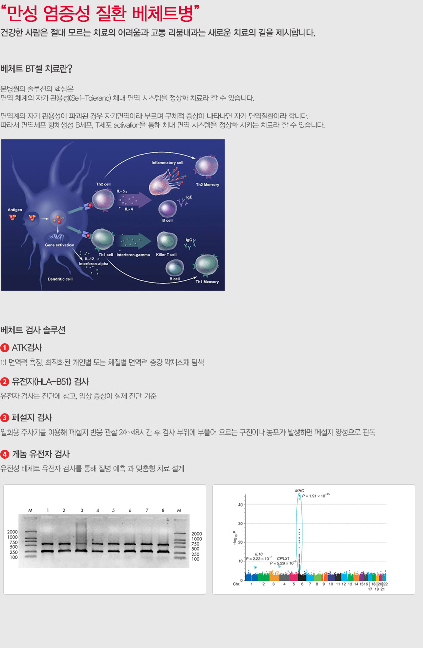 베체트병